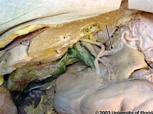 <p>what artery is being indicated to in the image?</p>