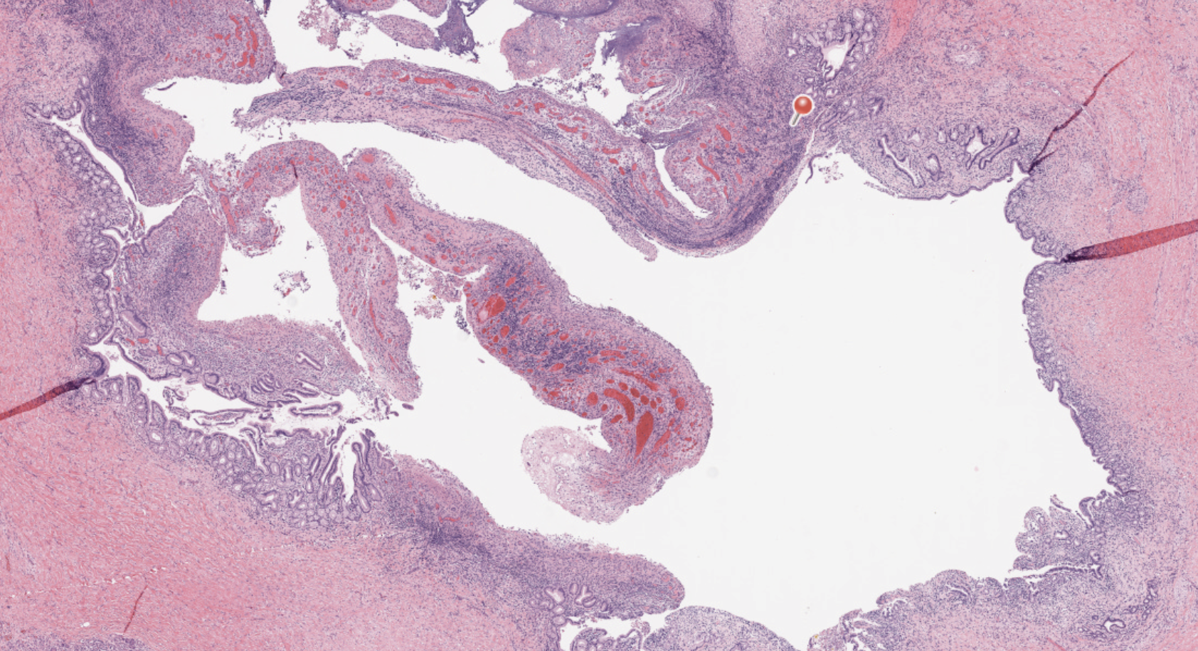 <p>Pancreas</p>