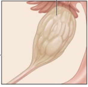 <p>Female reproductive organs located on either side of the uterus.</p>