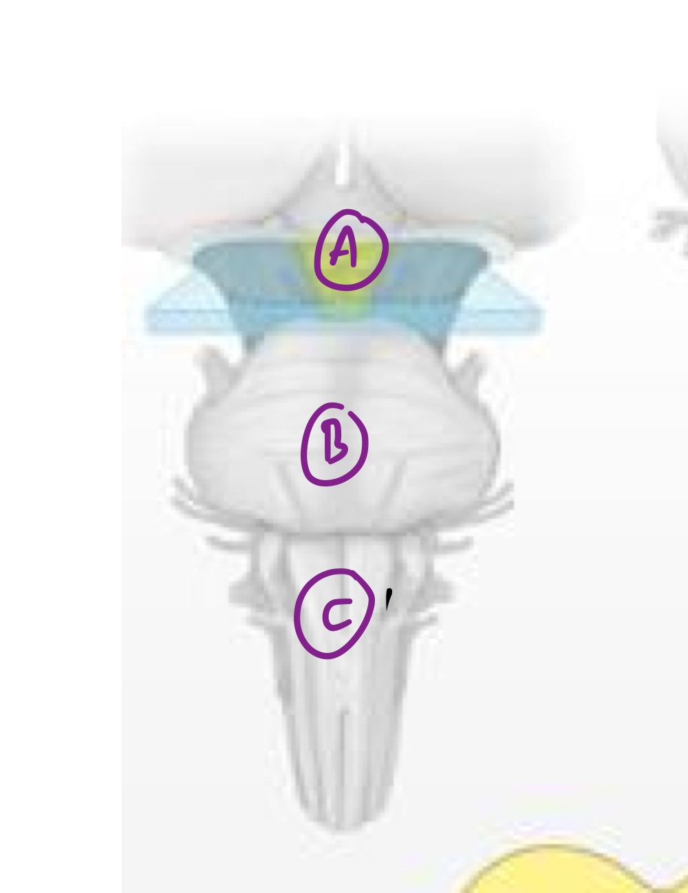 <p>What midsagittal brain stem structure is B? </p>