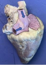 <p><span>Which vessels are these?&nbsp; They deliver oxygen poor blood to the right atrium</span></p>