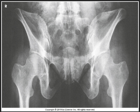 <p>What is this image demonstrating?</p>