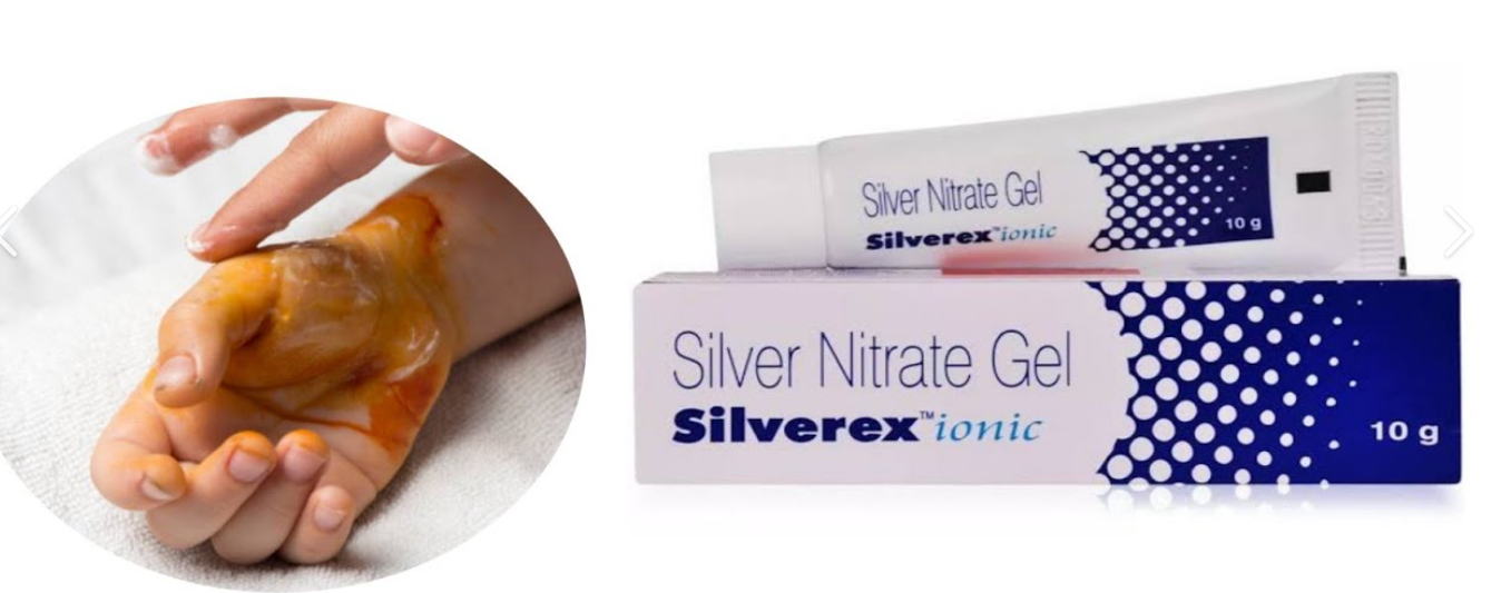 <ol><li><p><span style="color: rgb(172, 131, 28);"><strong>aseptic </strong></span><span style="color: rgb(14, 6, 6);">dressing change<strong> 2x daily</strong></span></p></li><li><p>wound <span style="color: rgb(233, 81, 240);"><strong>cultures 2x</strong> <strong>weekly</strong></span></p></li><li><p>topical <span style="color: rgb(27, 127, 93);"><strong>antimicrobial </strong>agents</span></p></li></ol><ul><li><p><span style="color: rgb(27, 127, 93);">SILVER nitrate</span></p></li><li><p><span style="color: rgb(27, 127, 93);">SILVER sulfadiazine</span></p></li><li><p><span style="color: rgb(27, 127, 93);">Sylfamyoin</span></p></li></ul><p></p>