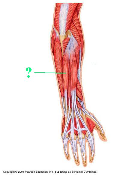 <p>Identify the indicated muscle</p>