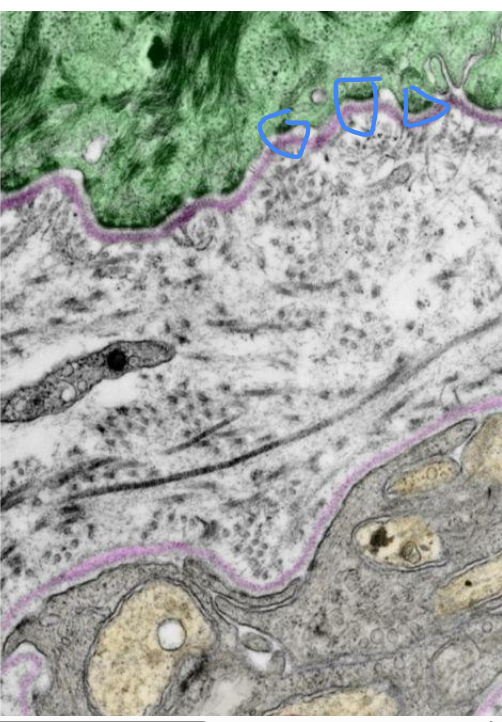 <p>Identify structure that is circled?</p>