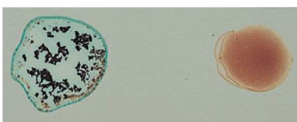 <p>What blood type is this?</p>