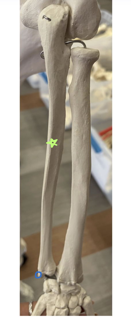<p>Green star: What is this structure?</p><p>Blue circle: What is this structure? </p><p>What muscle originates from the green star structure?</p>
