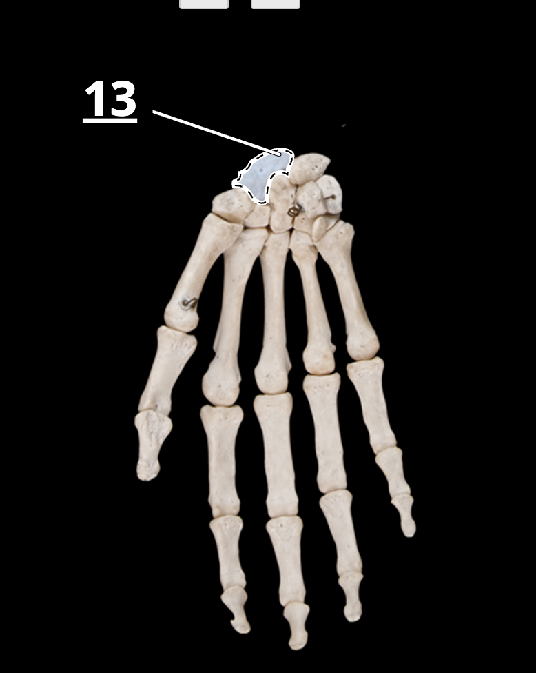 <p>13</p>