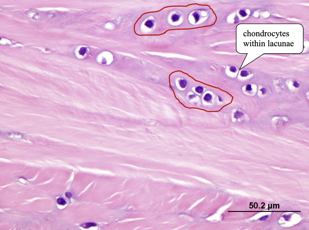 <p>ID the cartilage type in this image (hint: note the chondrocytes within lacunae)</p>
