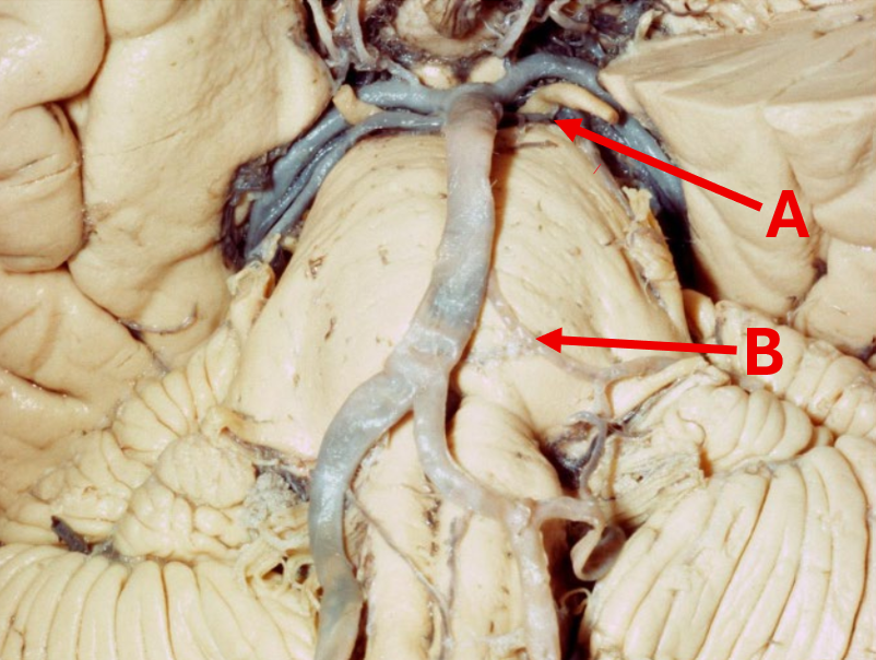 <p>What kind of nuclei damage and hence symptoms can we see from damaging A and B? </p>