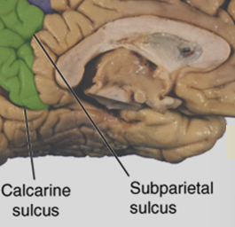 <p>Subparietal sulcus</p>
