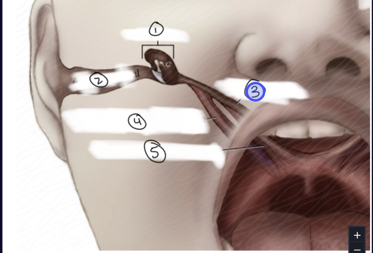 <p>ID #3 in blue </p>