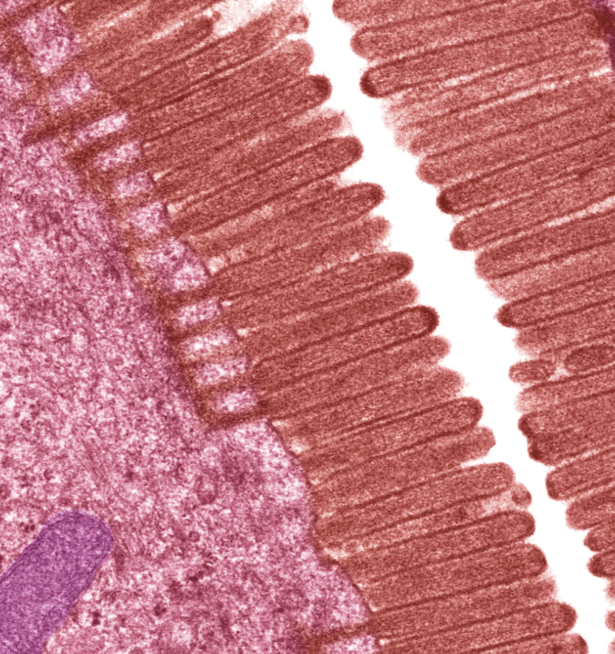 <p>Identify the microvilli</p>