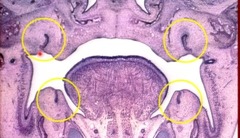 <p>circles show deep invaginations of dental lamina</p>