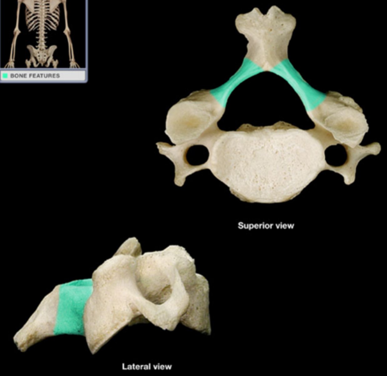 <p>Part of vertebral arch, before spinous process</p>