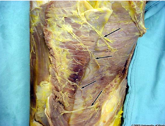 <p>what kind of nerves/vessels are being indicated in the image?</p>