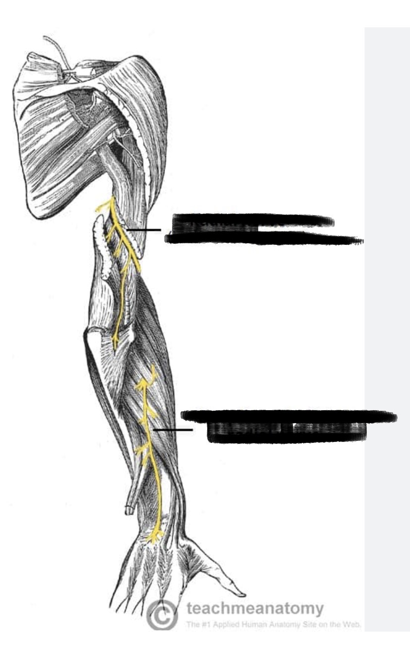<p>a major nerve in the arm that controls movement in the back of the arm, wrist, and hand, and provides feeling to parts of the skin. It runs from the neck and armpit down the back of the arm to the fingers.</p>