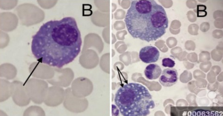 <p>what are russell bodies?</p>