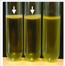 <p>What culture characteristics in broth is this?</p>