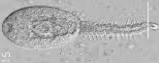 <p>Trichocercous</p>