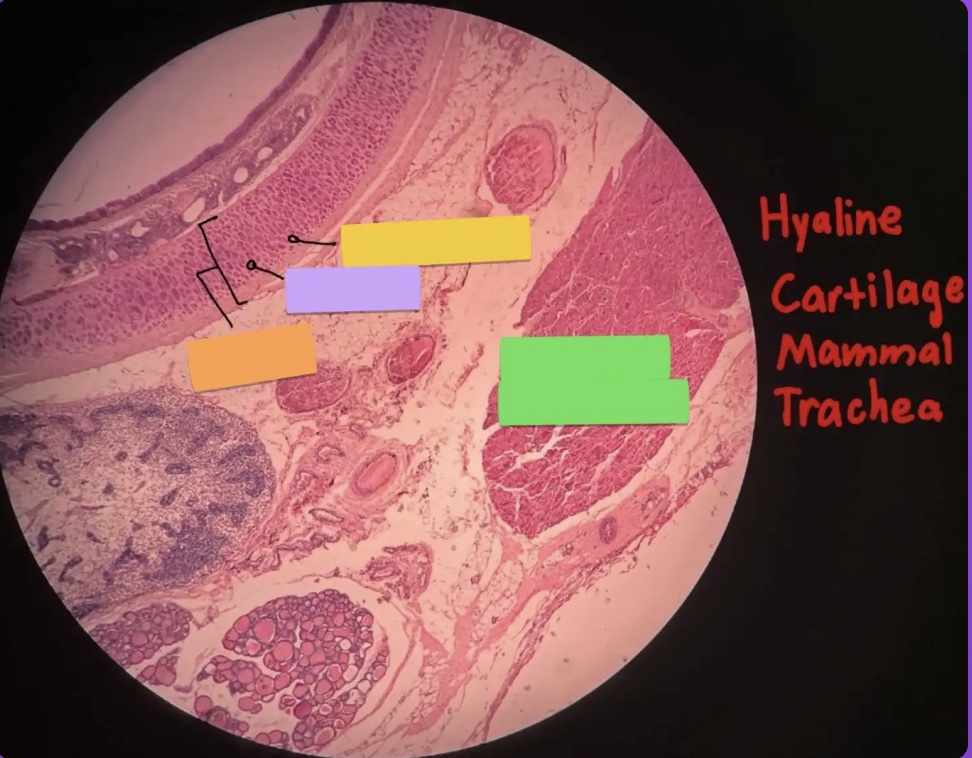 <p>What does the orange box represent?</p>