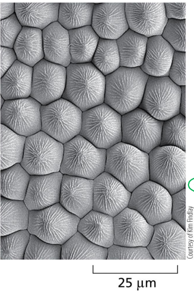 <p>What kind of micrograph is this?</p>