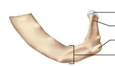 <p>Label the following:</p><ul><li><p>head</p></li><li><p>neck</p></li><li><p>tubercle</p></li><li><p>shaft</p></li></ul><p></p>