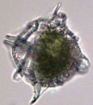 <ul><li><p>microbial eukaryote (domain: eukaryota)</p></li><li><p>produces saxitoxin</p></li><li><p>bioluminescent !! (in water)</p></li><li><p>phylum: Dinoflagellata</p></li><li><p>class: dinophyceae</p></li><li><p>order: Gonyaulacales</p></li></ul><p></p>