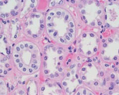 <p>Simple cuboidal epithelium</p>