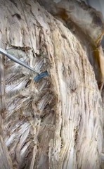 <p>Name the muscle</p>