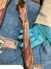 <p>Identify the muscle</p>