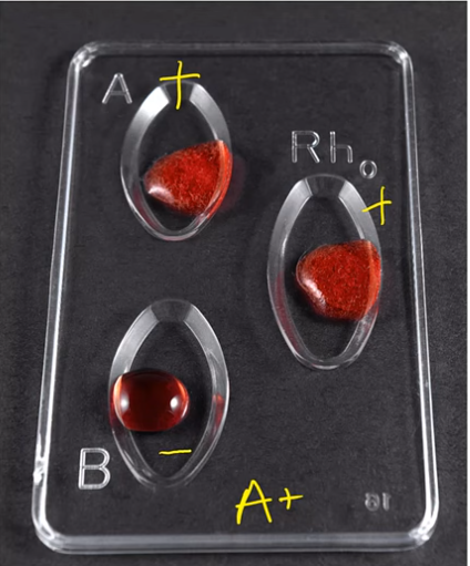 <p>A-POS</p>