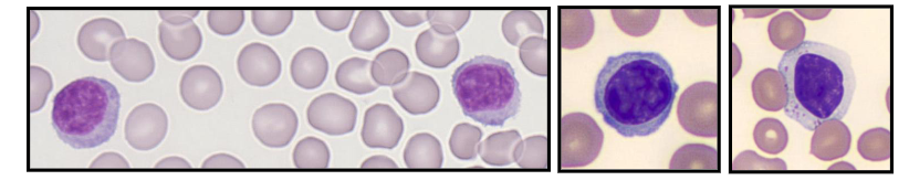 <p>Lymphocytes</p>