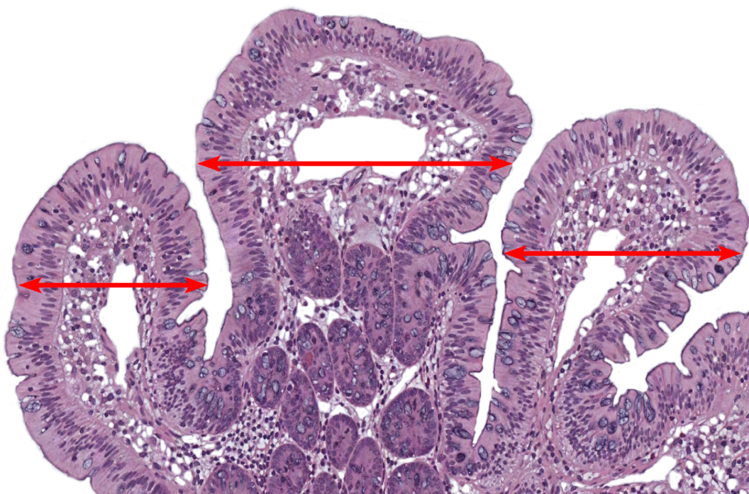 <p>Small Intestine</p><p><strong>NOTICE: THE FINGER-LIKE PROJECTIONS (VILLI) WITH OPEN SPACE INSIDE AND A FEW GRAY/BLUE GOBLET CELLS ALONG THE SIDES (NOT AS MANY AS LARGE INTESTINE</strong></p>