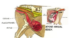 <p>What is the timeline of fetus descent and ascent?</p>