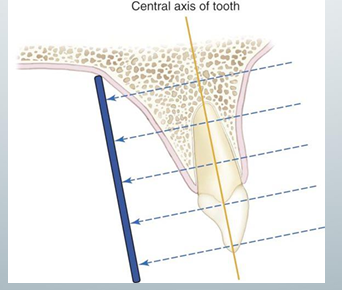 <p>-ensures minimal image distortion</p><p>-used by most dentists</p><p>-central x-ray beam directed at a right angle to the central axes of the object and the image receptor: 1) put XCP so the image receptor is parallel to teh tooth, 2) align the aiming cylinder parallel to the metal bar of the XCP</p>