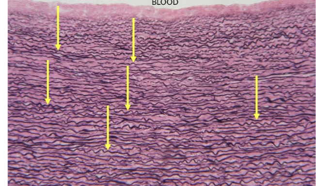 <p>identify the ECM portein </p>