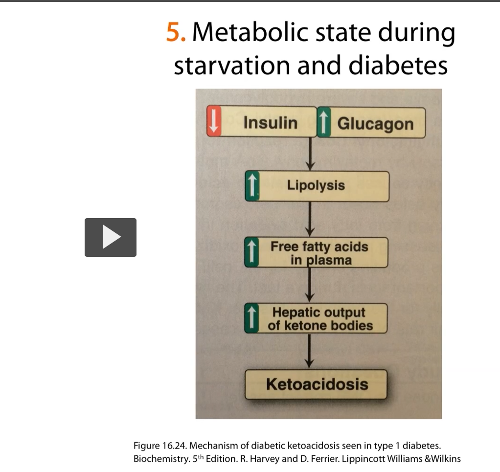<p><u>untreated diabetes</u></p><p>during <strong>uncontrolled diabetes </strong>or <strong>prolonged states of fasting</strong> what happens is <strong>decrease in insulin</strong> and an <strong>increase </strong>in <strong>glucagon</strong> and there is an <strong>increase</strong> of <strong>fatty acid synthesis </strong>in <strong>plasma</strong>, and so the <strong>hepatic output </strong>of <strong>ketone bodies </strong>is <strong>increased</strong> and therefore the <strong>patient suffers from ketoacidosis</strong>. </p><p>-this is something that you need to be aware of for <strong>untreated diabetes</strong>. </p>