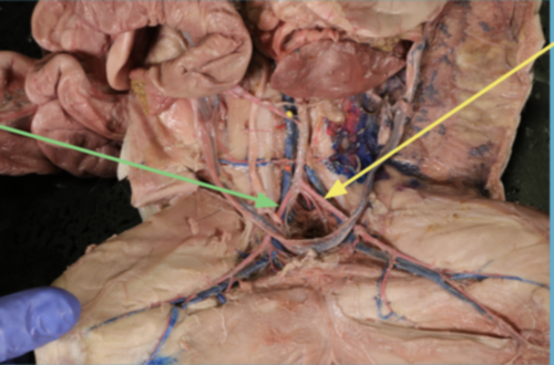 <p>green arrow (artery)</p>