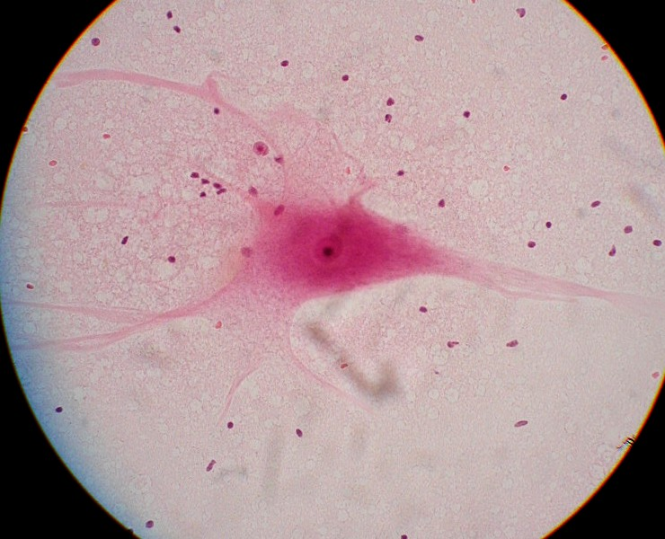 <p>ID Cell (big pink one)</p>