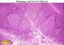 <p>which type of connective tissue is this?</p>