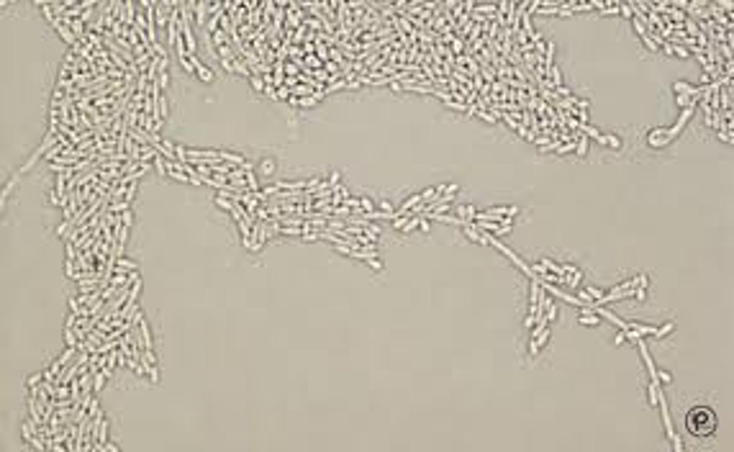 <p>Elongated blastoconidia at junction</p><p>Log-jam clusters</p>