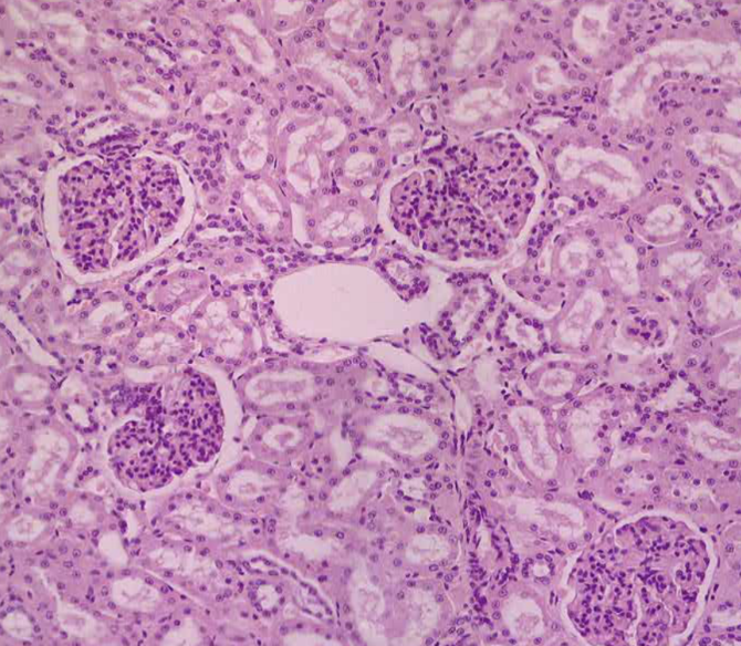 <ol><li><p>Sickle Cell Anemia</p></li><li><p>Atherosclerosis</p></li><li><p>Adenocarcinoma of Kidney</p></li><li><p>Osteogenic Sarcoma of Bone</p></li><li><p>Tattoo in Human Skin</p></li><li><p>Neurilemmoma</p></li><li><p>Anthracosis of the Lung</p></li><li><p>Basal Cell Carcinoma</p></li><li><p>Lung</p></li><li><p>Skeletal</p></li><li><p>Kidney</p></li><li><p>Neuron</p></li><li><p>Skin</p></li><li><p>Blood</p></li><li><p>Bone</p></li><li><p>Aorta</p></li></ol><p></p>