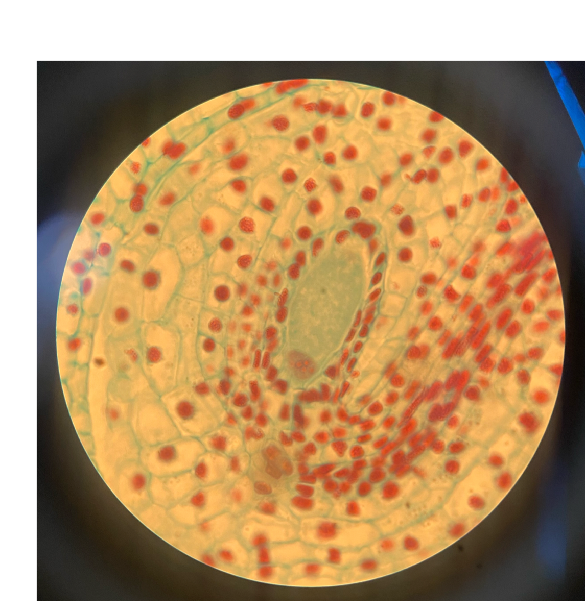 <p>Is this gamete a Female or Male?</p>