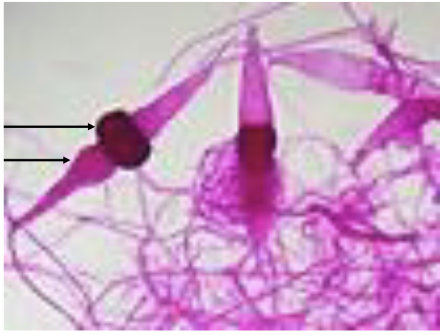 <p>top line?</p>