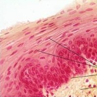 <p>- keratinized epidermis</p><p>- nonkeratinized orifices, espophagous</p>