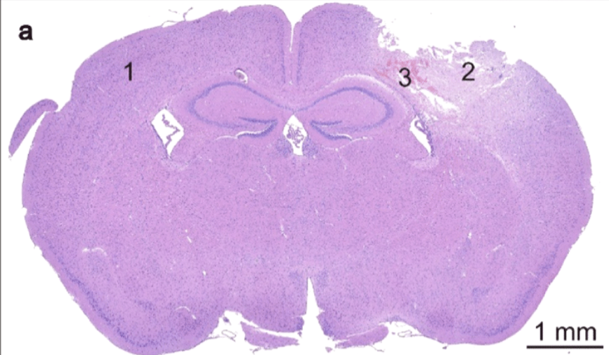 <p>a type of light microscope that is good for stained tissue - histology, PLAP, LacZ, etc. </p>