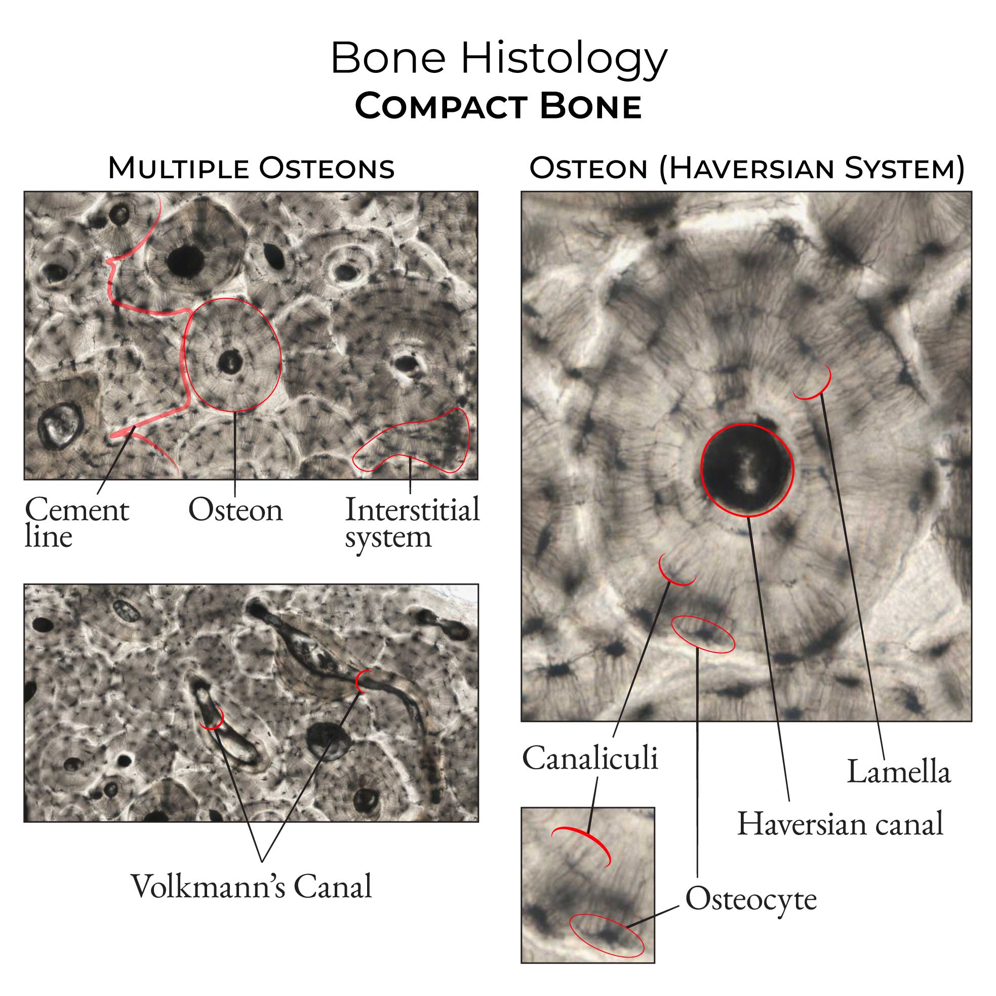 <p>Look for canals that connect central canals with one another or with the marrow cavity rather than forming the central core of a concentric osteon.</p>