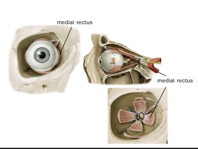 <p>Adduction of eyeball</p>