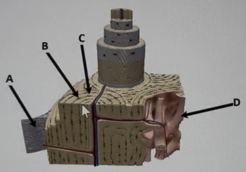 <p>identify B inside a lacuna </p>